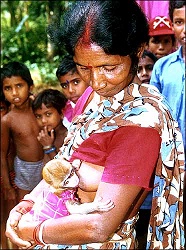 Indians Breast