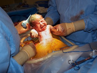 childbirth